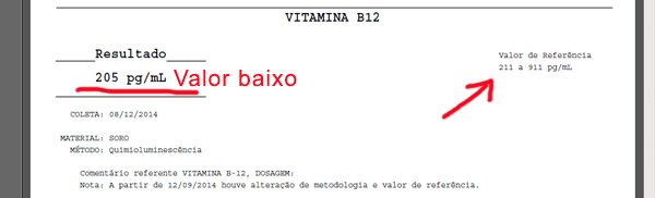 exame de vitamina B12 baixa