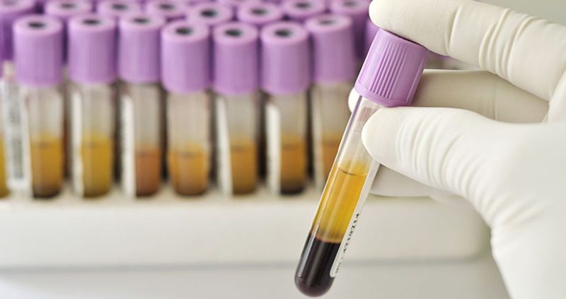 exames de sangue e referências